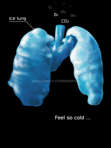 冰肺-ice lung